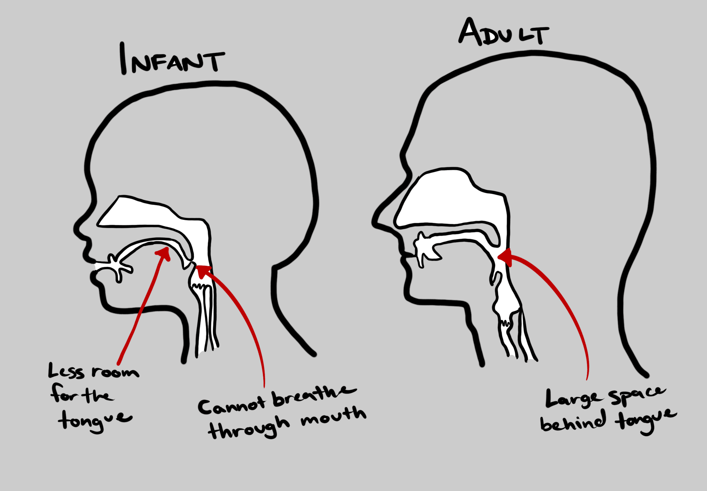 A drawing of a cross-section of the head of an infant and of an adult. In each, the mouth, throat, and nasal cavity is highlighted. On the infant, an arrow labeled "less room for the tongue" points to the size of the tongue and another arrow points to a flap at the back of the mouth. This reads "cannot breathe through the mouth." On the adult an arrow points to the back of the tongue that reads "large space behind tongue."
