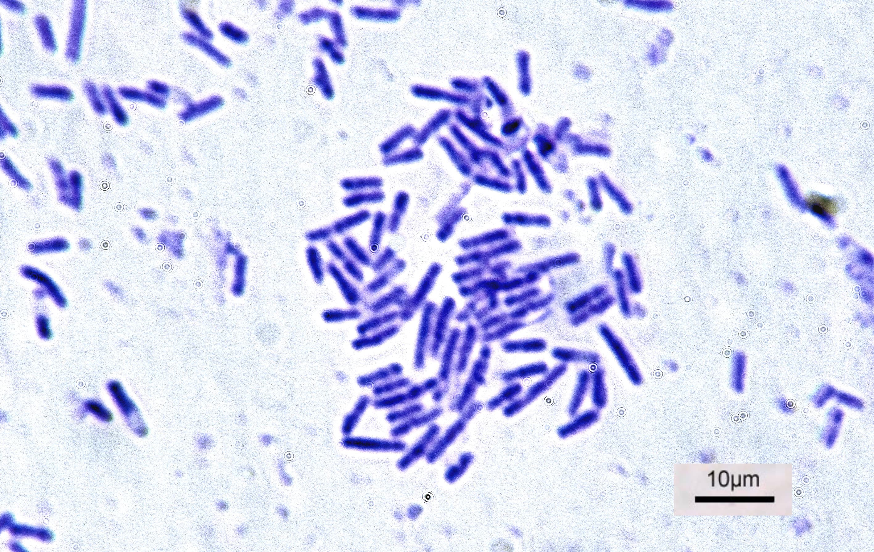 A microscope photograph of rod-shaped bacteria died purple.